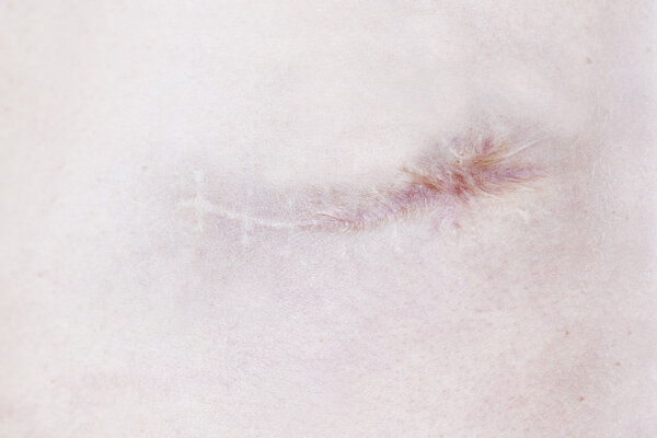 Боль и шрамы
