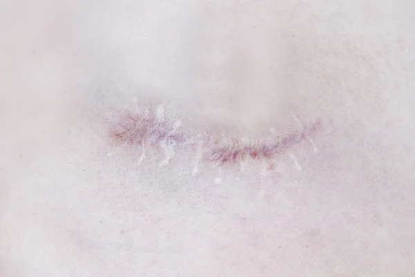 Dor e cicatrizes — Fotografia de Stock