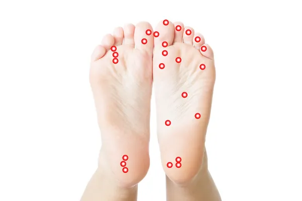 Acupressure of female feet — Stock Photo, Image