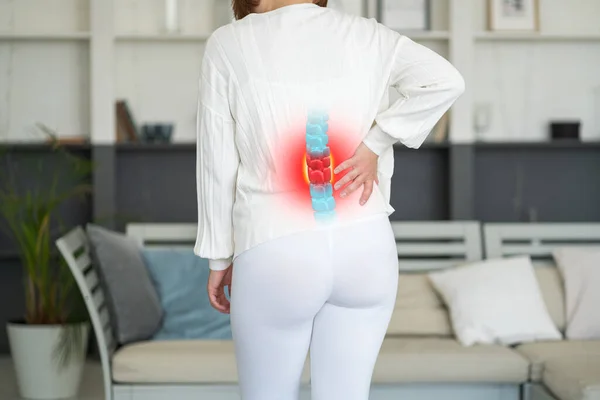 Lumbar Intervertebrale Wervelkolom Hernia Vrouw Met Rugpijn Thuis Wervelschijf Ziekte — Stockfoto