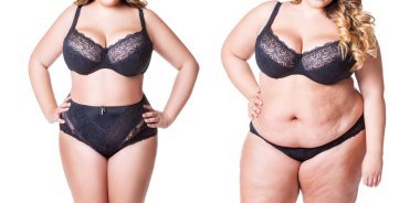 Kadın vücudu önce ve sonra beyaz arka plan üzerinde plastik cerrahi kavramı izole kilo kaybı