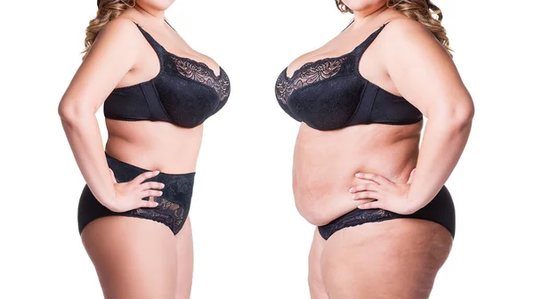 Woman Body Weight Loss Isolated White Background Plastic Surgery Concept — Stock Photo, Image