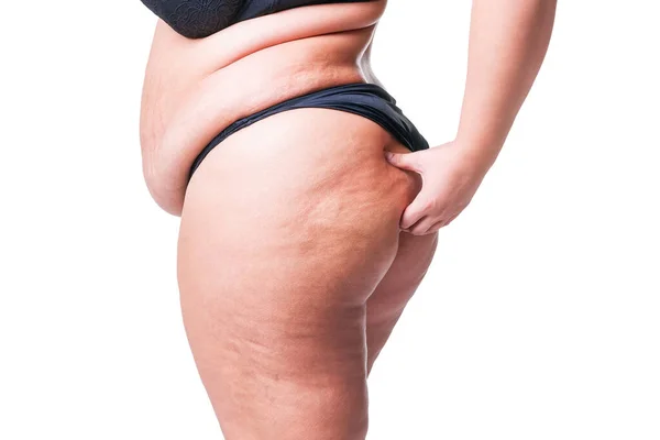 Overweight Woman Fat Cellulite Legs Buttocks Obesity Female Body Isolated — Stock Photo, Image