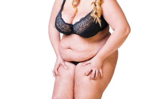 Mujer Con Sobrepeso Con Vientre Piernas Celulitis Grasa Obesidad Cuerpo — Foto de Stock