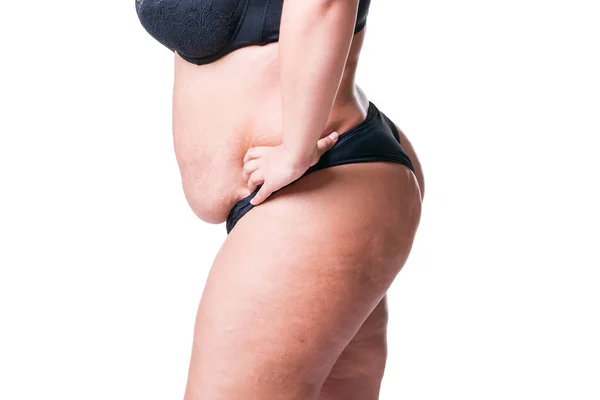 Übergewichtige Frau Mit Fetten Cellulite Beinen Fettleibigkeit Weiblicher Körper Isoliert Stockbild