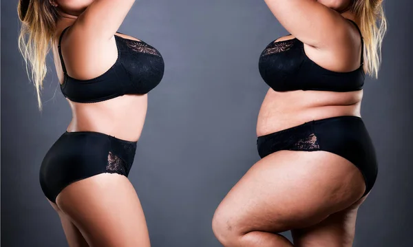 Frauenkörper Vor Und Nach Der Gewichtsabnahme Auf Grauem Hintergrund Konzept — Stockfoto
