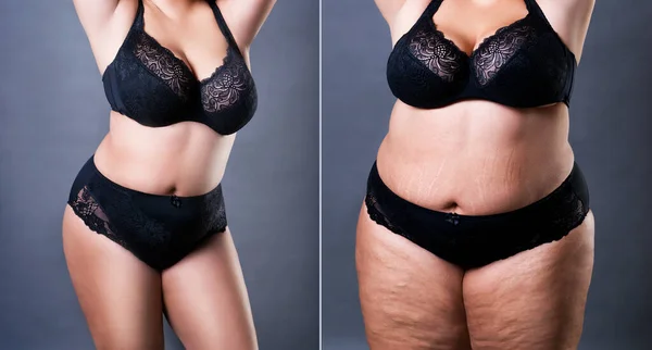 Woman\'s body before and after weight loss on gray background, plastic surgery concept