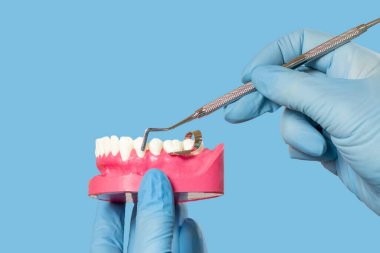 Dişçinin ellerinin lateks eldivenlerle yakın plan görüntüsü, insan çenesi ve evrensel bir kürette. Tıbbi araçlar konsepti.