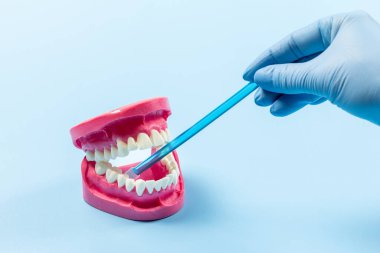 Dişçinin elinde lateks eldiven, tükürük püskürtücü ve mavi arka planda insan çene yapısı var. Tıbbi araçlar konsepti.