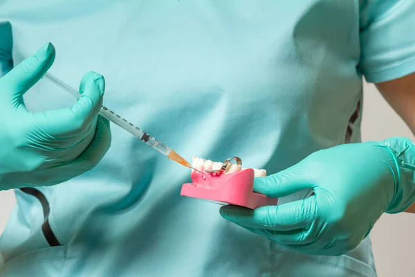 Manos Del Dentista Sosteniendo Una Disposición Mandíbula Humana Una Jeringa — Foto de Stock