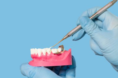 Diş hekimi elleri insan çene düzeni ve diş yenileme aracı ile.