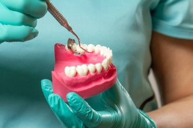 Diş hekiminin ellerinin lateks eldivenlerle yakın plan görüntüsü, insan çenesi ve küret. Tıbbi araçlar konsepti.