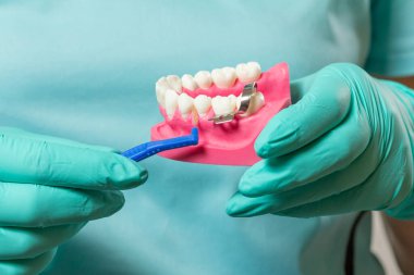 Bir insan çene düzeni ve interdental kürdan fırçası ile dişçinin ellerinin yakın görüntüsü..