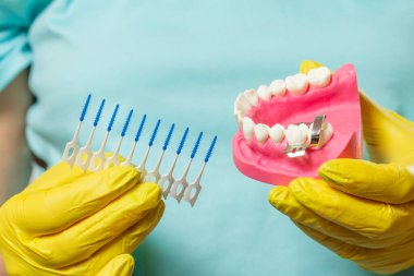 İnsan çene düzeni ve interdental kürdan fırçaları ile dişçinin ellerinin yakın görüntüsü.