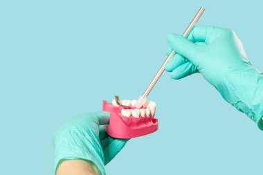 Tükürük püskürtücü ve insan çene yapısı olan lateks eldivenli dişçi elleri. Tıbbi araçlar konsepti.
