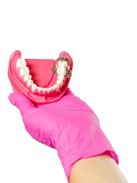 歯医者は白い隔離された背景に人間の顎のレイアウトとラテックス手袋で手 — ストック写真