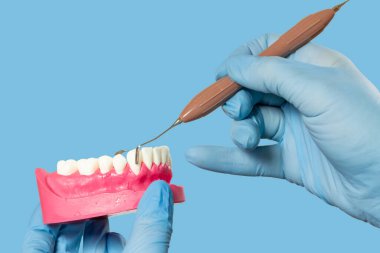 Ellerin lateks eldivenlerle yakın plan görüntüsü, insan çenesi yapısı ve diş yenileme aleti. Tıbbi araçlar konsepti.