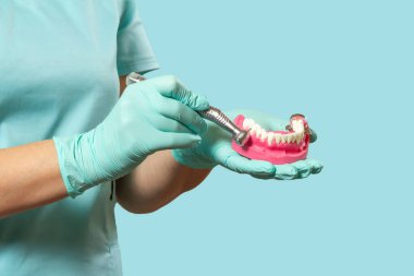 Yüksek hızlı dişçi çantası ve diş hekiminin elinde insan çenesi tasarımı var. Diş tedavisi için diş aletleri.