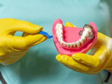 Close-up view of dentist's hands with the human jaw layout and the interdental toothpick brush.