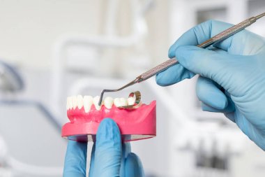 Diş hekimlerinin eldiven giyip, insan çenesi ve evrensel bir curette çizimine sahip eldiven taktıkları yakın çekim görüntüsü. Arka planda dişçi ofisi var. Tıbbi araçlar konsepti.