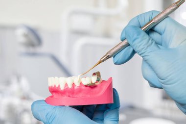 Diş hekimlerinin yakın plan görüntüsü, lateks eldivenli elleri, insan çenesinin yapısı ve diş yenileme aleti. Arka planda dişçi ofisi var. Tıbbi araçlar konsepti.