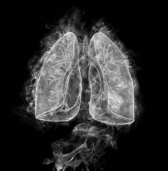 Human lungs and bronchi — Stock Photo, Image