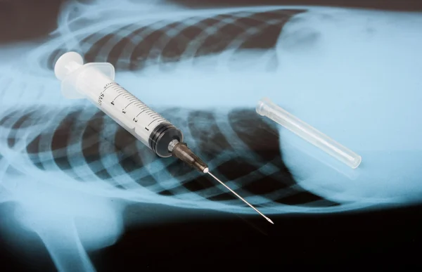 Syringe on x-ray — Stock Photo, Image