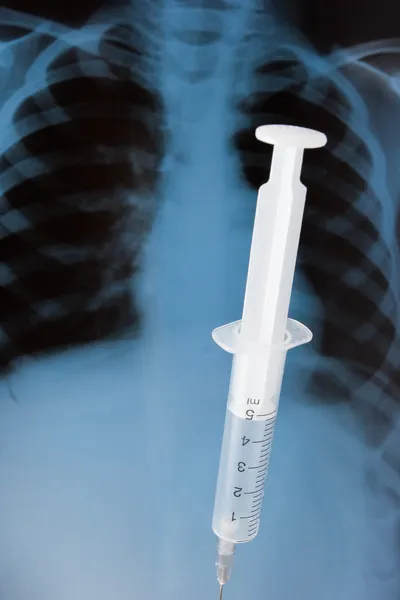 Syringe on x-ray background — Stock Photo, Image