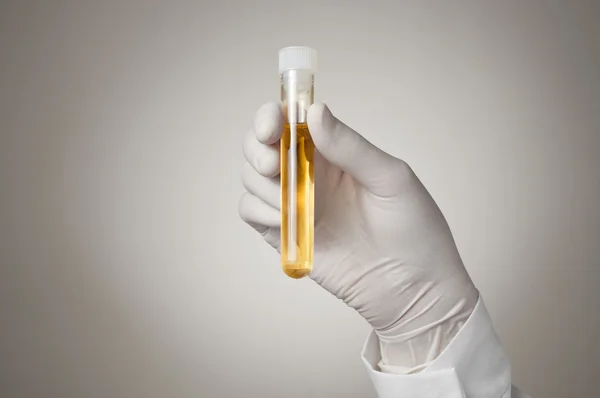 Mão do médico com amostra de urina — Fotografia de Stock