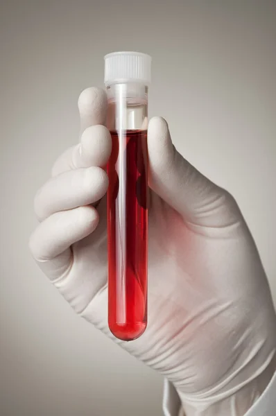 Doctor's hand with blood sample — Stock Photo, Image
