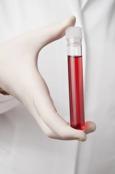 Doctor's hand with blood sample — Stock Photo, Image