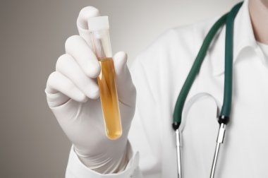 Doctor's hand with urine sample clipart