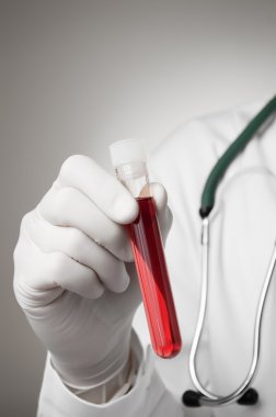 Doktor el ile kan örneği