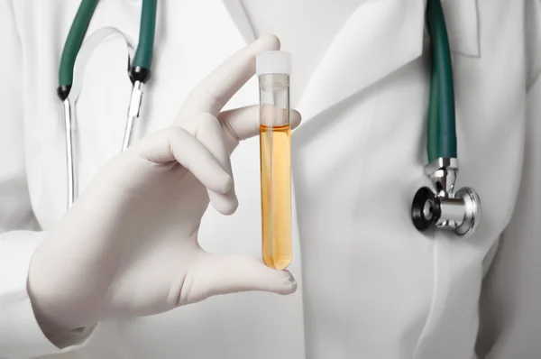 Main du médecin avec échantillon d'urine — Photo