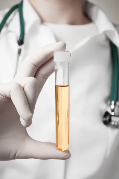 Main du médecin avec échantillon d'urine — Photo