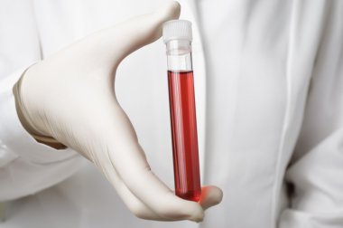 Doktor el ile kan örneği