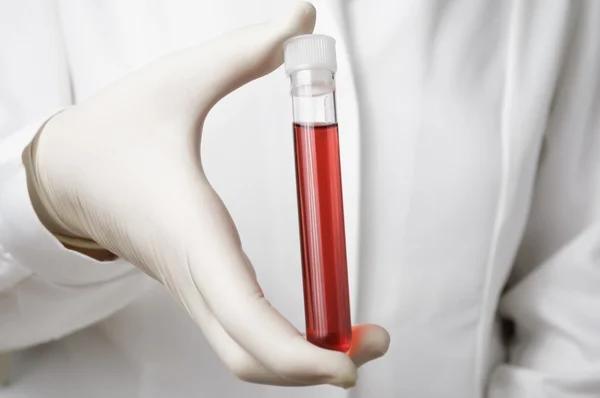 Doctor's hand with blood sample — Stock Photo, Image