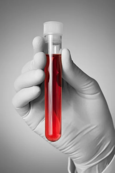 Doctor's hand with blood sample — Stock Photo, Image