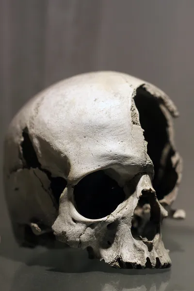 Human skull — Stock Photo, Image