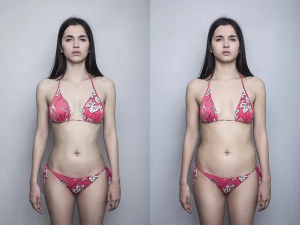 Chica joven retrato antes después de grasa y delgado — Foto de Stock