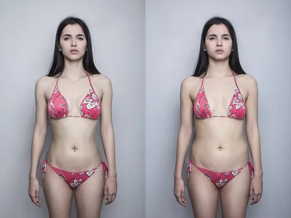 Retrato jovem menina antes depois de gordura e magro Fotos De Bancos De Imagens