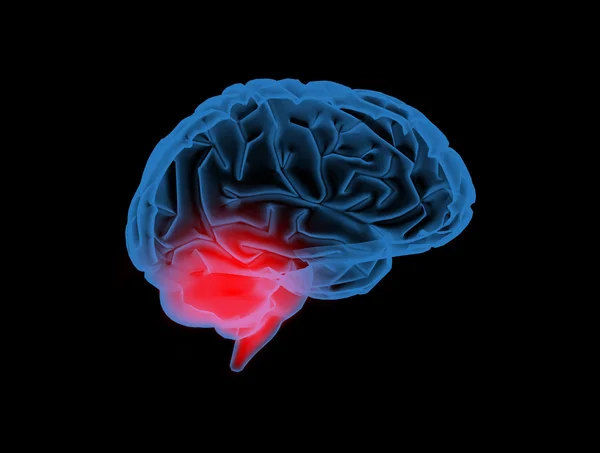 X-ray neuropatologii — Zdjęcie stockowe