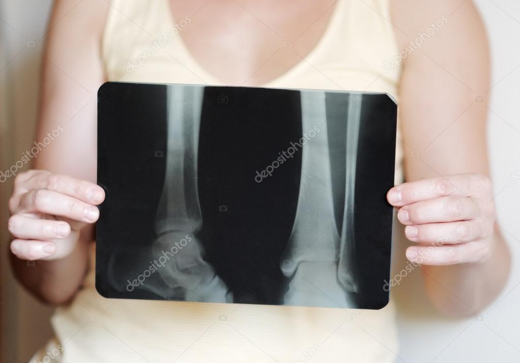 X-ray image of legs