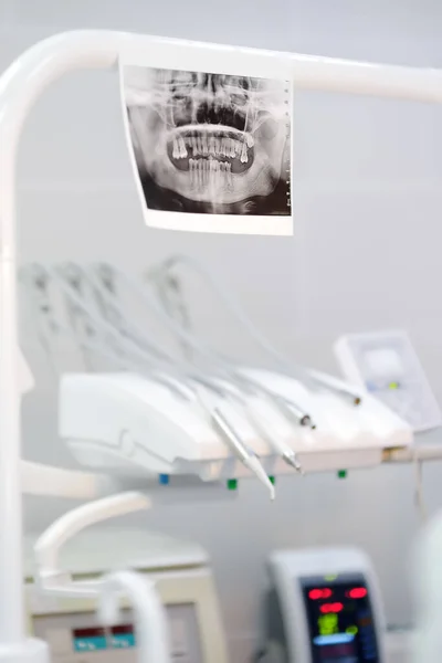 在医院或诊所进行牙科手术时 以专业牙科设备和工具为背景的X光照片 把注意力集中在X光上安装假牙的现代技术 — 图库照片