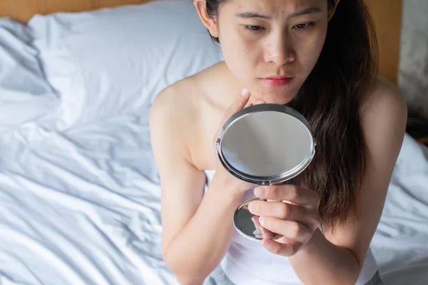 Close Asian Woman Worry Her Face She Saw Problem Acne — Fotografia de Stock
