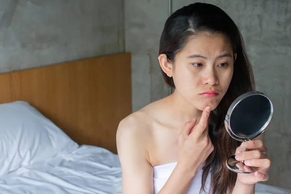Portrait Asian Woman Worry Her Face She Saw Problem Acne — Fotografia de Stock