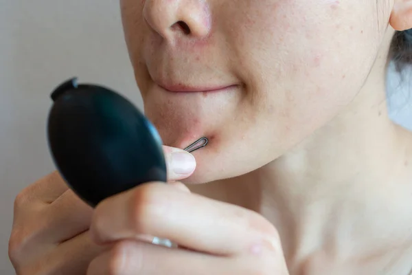 Yüzündeki sivilceleri ve sivilceleri sıkmak için aletler kullanan genç bir kadın görüntüsü. Sivilcelerle ve kadın derisinde yara izleri var..