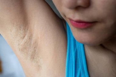 Close up of woman showing her unshaved armpit. Unshaven women often meet other criteria for traditional feminine beauty. clipart