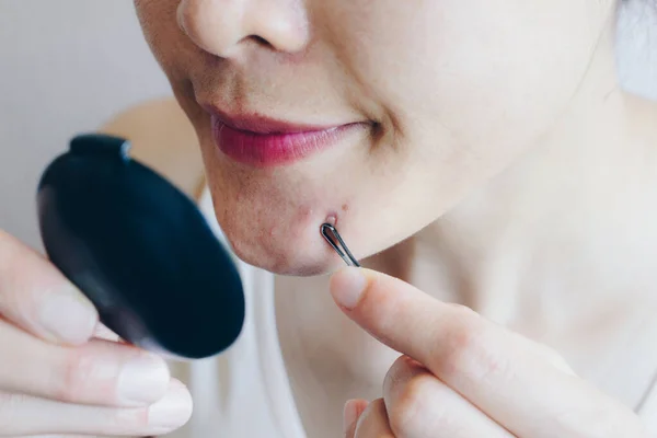 Cropped Shot Young Woman Using Tools Squeeze Pimples Acne Her — Stock Fotó