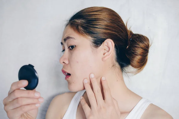 Portrait Asian Woman Shocked She Saw Problem Acne Scar Her — Stockfoto